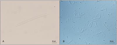 Cutaneous filarioid nematodes of dogs in the United States: Are they emerging, neglected, or underdiagnosed parasites?